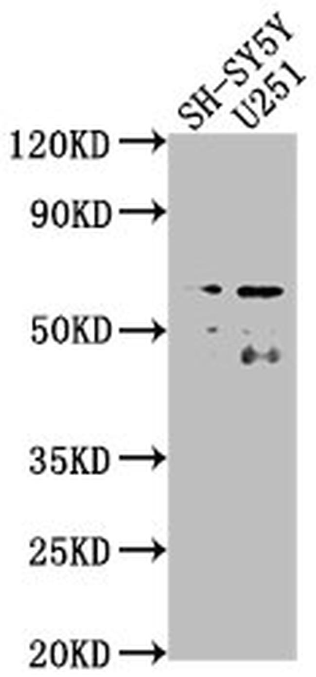 TAIP2 Antibody in Western Blot (WB)