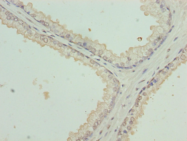 Cytokeratin 35 Antibody in Immunohistochemistry (Paraffin) (IHC (P))