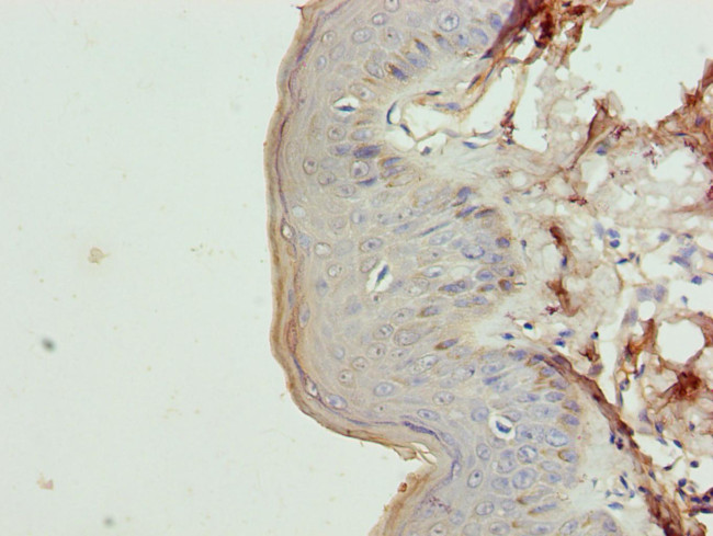 Cytokeratin 35 Antibody in Immunohistochemistry (Paraffin) (IHC (P))