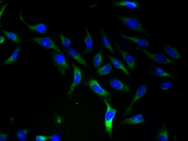 SLC25A46 Antibody in Immunocytochemistry (ICC/IF)