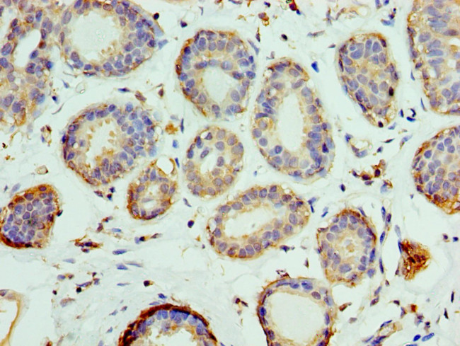 Pellino 1 Antibody in Immunohistochemistry (Paraffin) (IHC (P))