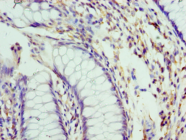 Pellino 1 Antibody in Immunohistochemistry (Paraffin) (IHC (P))