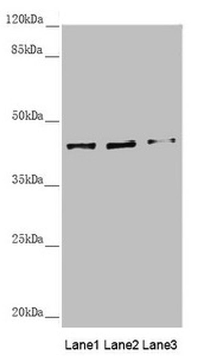 SCRN2 Antibody in Western Blot (WB)