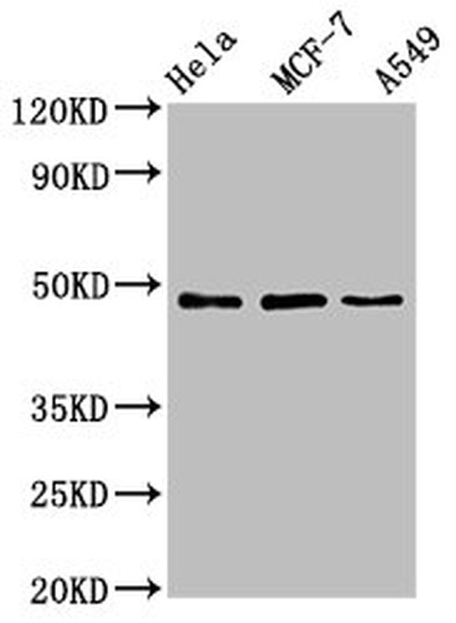 LCOR Antibody in Western Blot (WB)