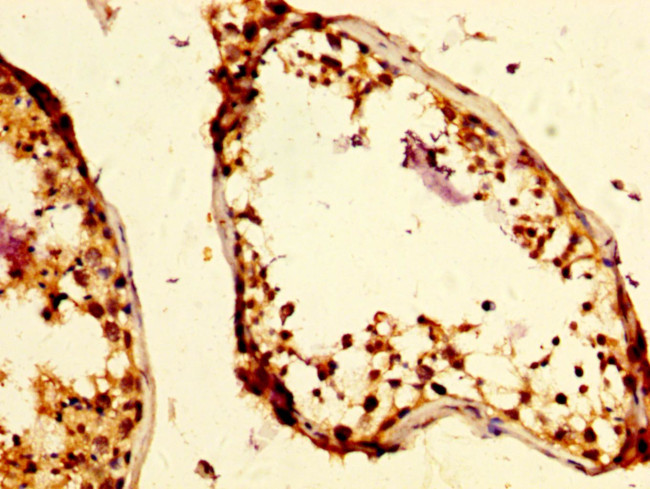 RAP80 Antibody in Immunohistochemistry (Paraffin) (IHC (P))