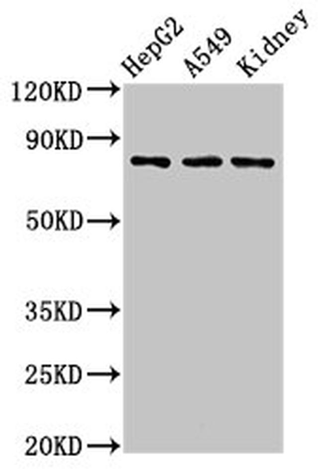 RAP80 Antibody in Western Blot (WB)