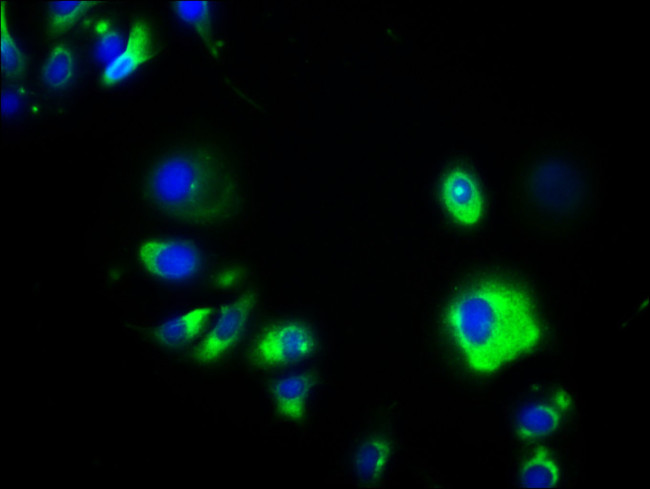 A33 Antibody in Immunocytochemistry (ICC/IF)