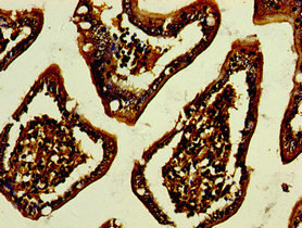 A33 Antibody in Immunohistochemistry (Paraffin) (IHC (P))