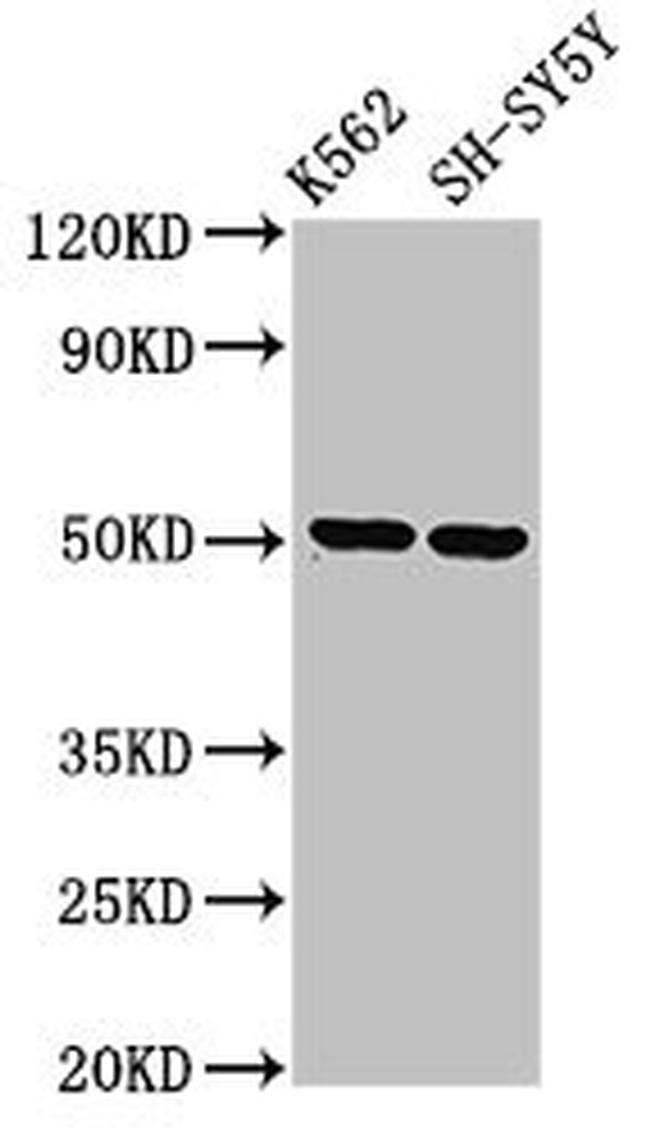 A33 Antibody in Western Blot (WB)