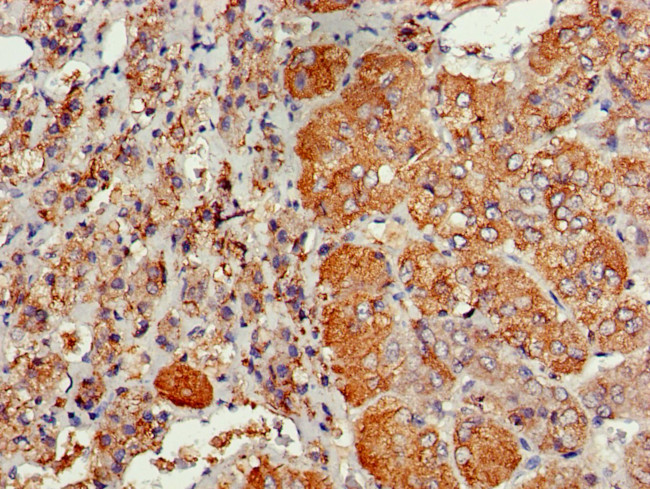 Cdc6 Antibody in Immunohistochemistry (Paraffin) (IHC (P))