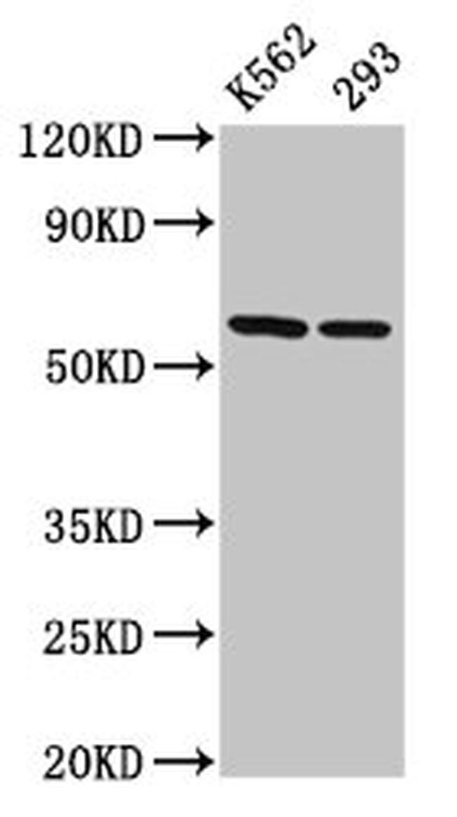 TCP-1 eta Antibody in Western Blot (WB)