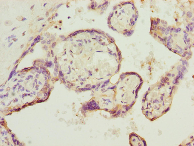 SH3GL1 Antibody in Immunohistochemistry (Paraffin) (IHC (P))