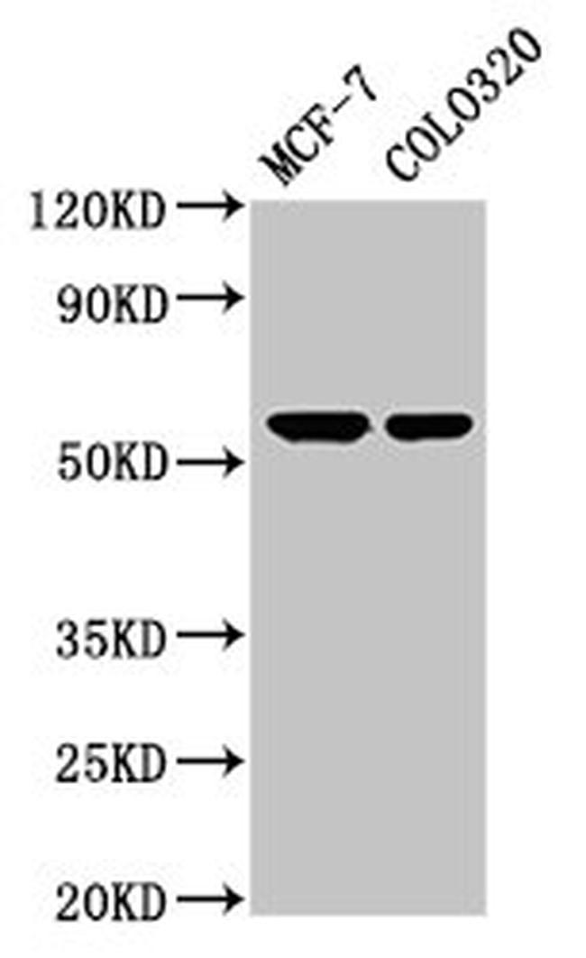 MYOC Antibody in Western Blot (WB)