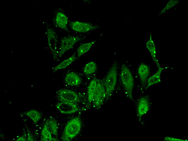 PITX2 Antibody in Immunocytochemistry (ICC/IF)