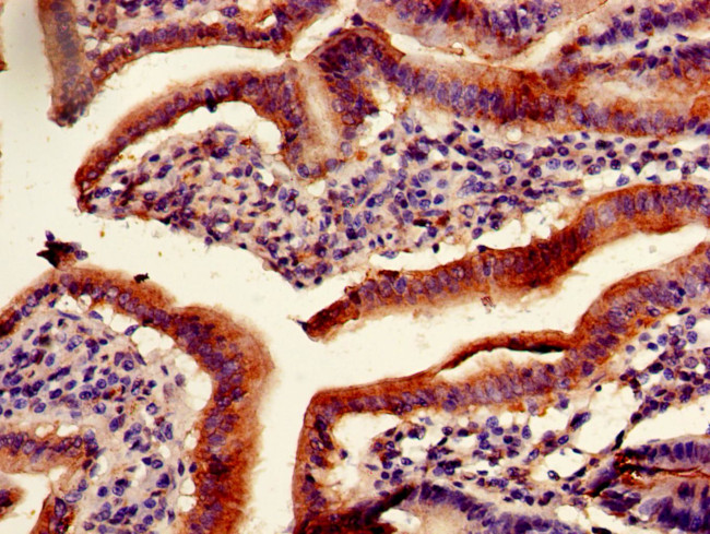 PITX2 Antibody in Immunohistochemistry (Paraffin) (IHC (P))