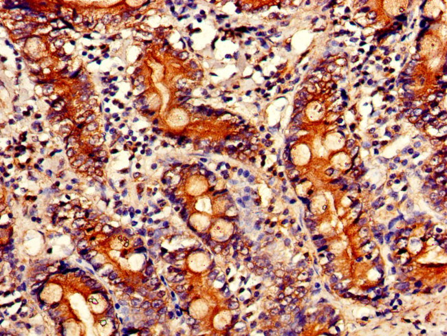 PITX2 Antibody in Immunohistochemistry (Paraffin) (IHC (P))