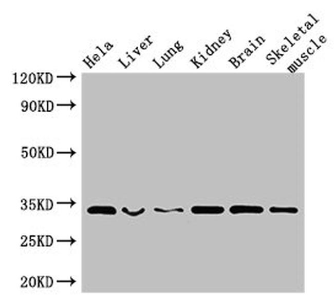 Calponin 2 Antibody in Western Blot (WB)