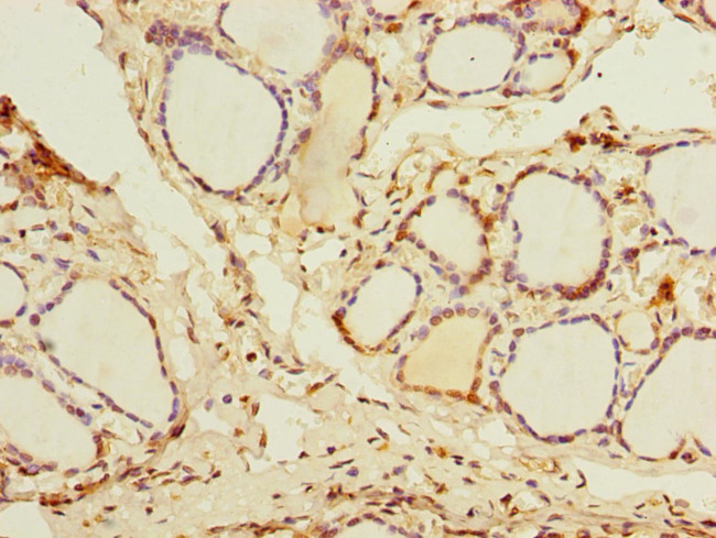 DDX50 Antibody in Immunohistochemistry (Paraffin) (IHC (P))