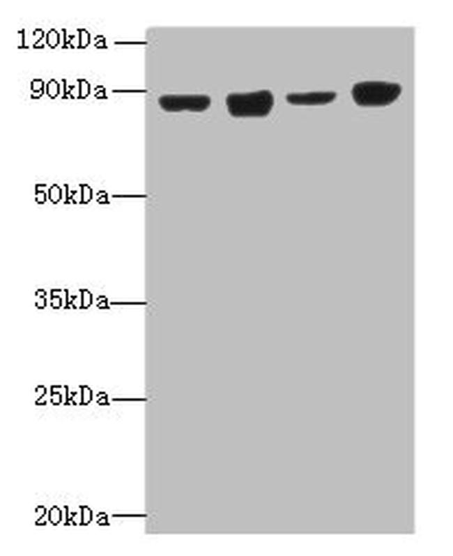 DDX50 Antibody in Western Blot (WB)