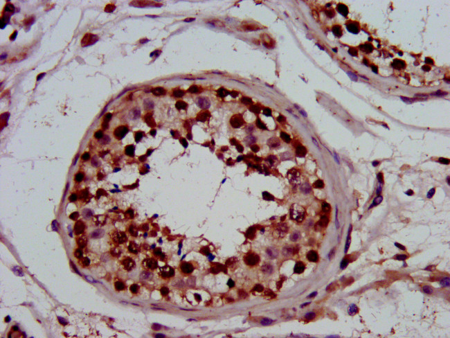 PIN4 Antibody in Immunohistochemistry (Paraffin) (IHC (P))