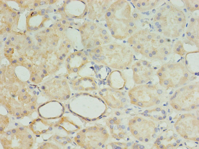 MRPL18 Antibody in Immunohistochemistry (Paraffin) (IHC (P))