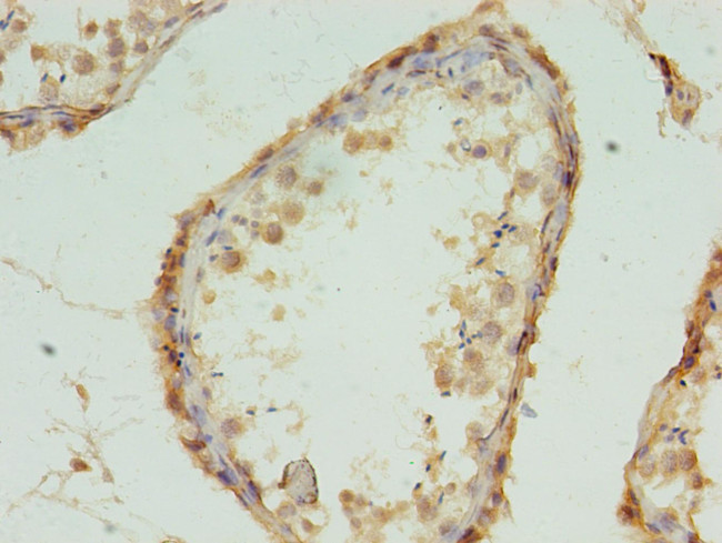 MRPL18 Antibody in Immunohistochemistry (Paraffin) (IHC (P))