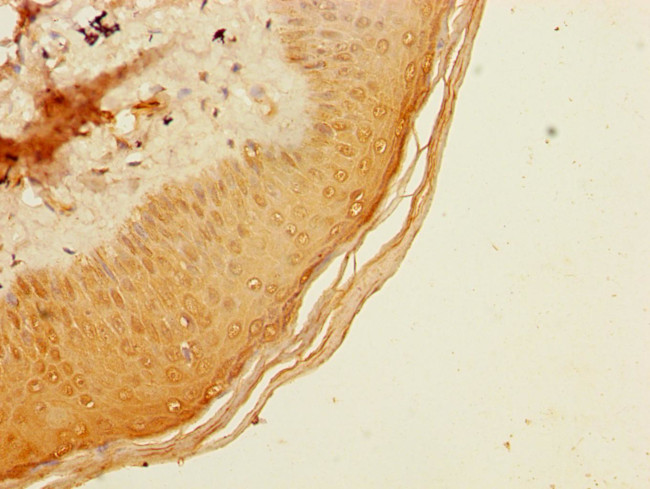 ADAT1 Antibody in Immunohistochemistry (Paraffin) (IHC (P))