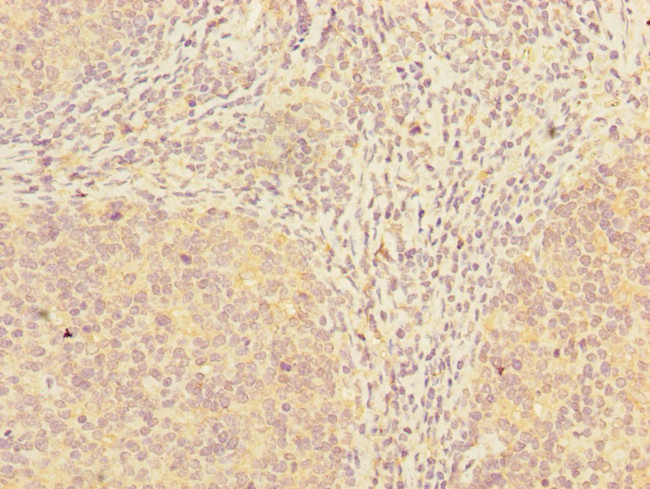 ADAT1 Antibody in Immunohistochemistry (Paraffin) (IHC (P))