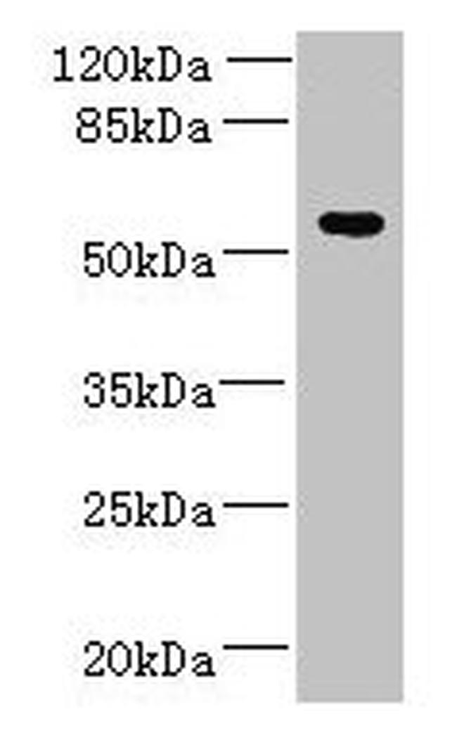 ADAT1 Antibody in Western Blot (WB)