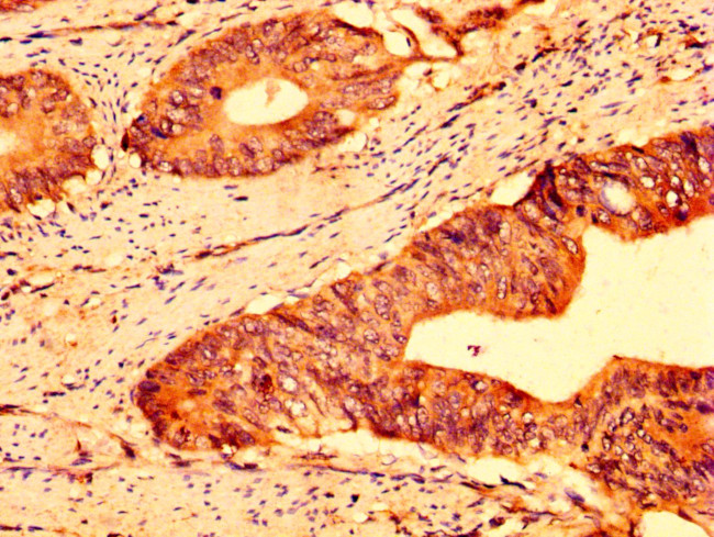 ABCG5 Antibody in Immunohistochemistry (Paraffin) (IHC (P))