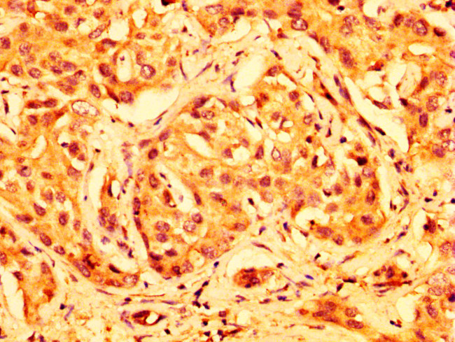 ABCG5 Antibody in Immunohistochemistry (Paraffin) (IHC (P))