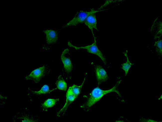 NARFL Antibody in Immunocytochemistry (ICC/IF)