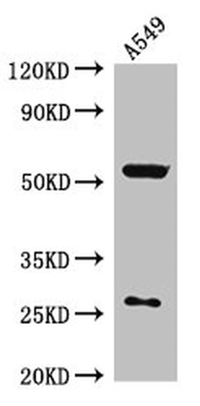 NARFL Antibody in Western Blot (WB)