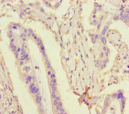 TDRD3 Antibody in Immunohistochemistry (Paraffin) (IHC (P))