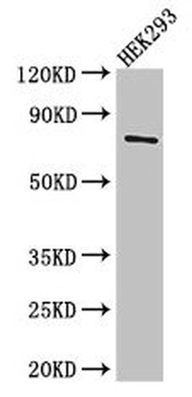 TDRD3 Antibody in Western Blot (WB)