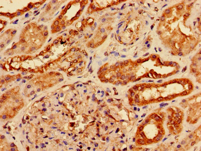 AGPAT3 Antibody in Immunohistochemistry (Paraffin) (IHC (P))