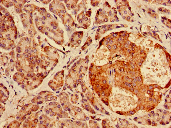 AGPAT3 Antibody in Immunohistochemistry (Paraffin) (IHC (P))