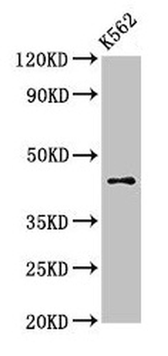 AGPAT3 Antibody in Western Blot (WB)