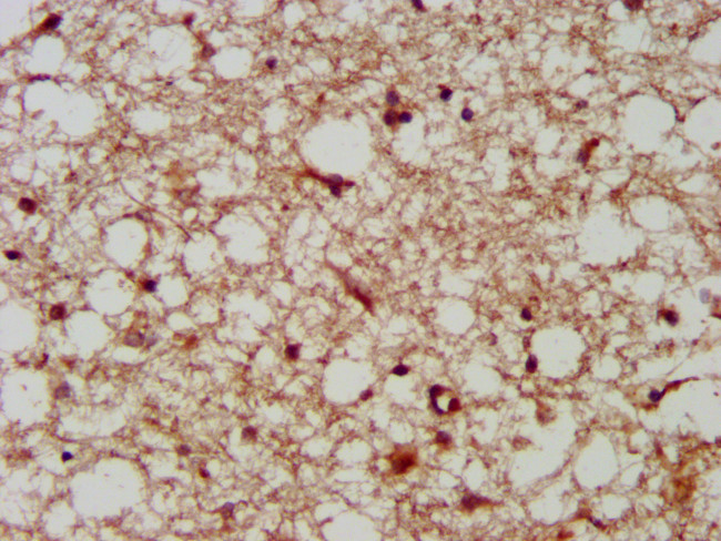 LANCL2 Antibody in Immunohistochemistry (Paraffin) (IHC (P))