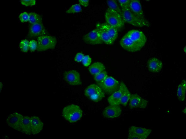 SPTLC3 Antibody in Immunocytochemistry (ICC/IF)