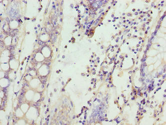 SPTLC3 Antibody in Immunohistochemistry (Paraffin) (IHC (P))