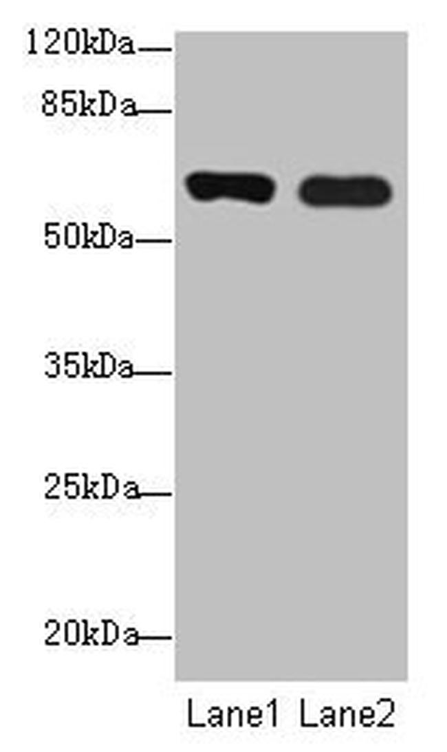 SPTLC3 Antibody in Western Blot (WB)