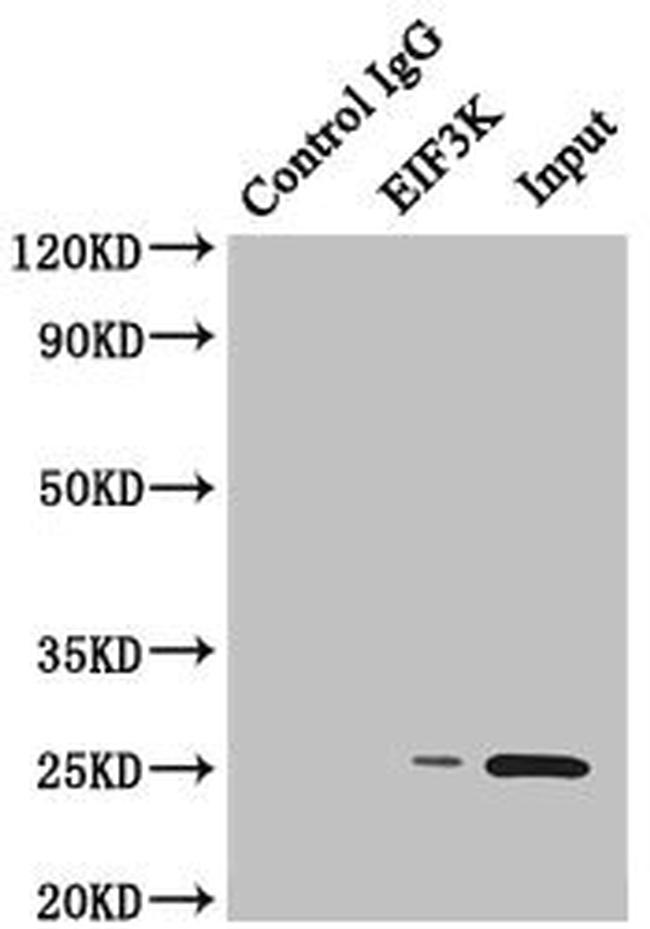 eIF3k Antibody in Western Blot (WB)