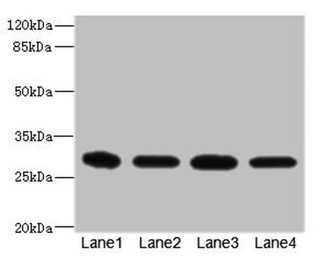 eIF3k Antibody in Western Blot (WB)