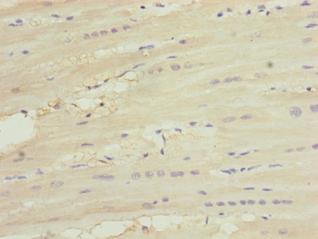 MNF1 Antibody in Immunohistochemistry (Paraffin) (IHC (P))