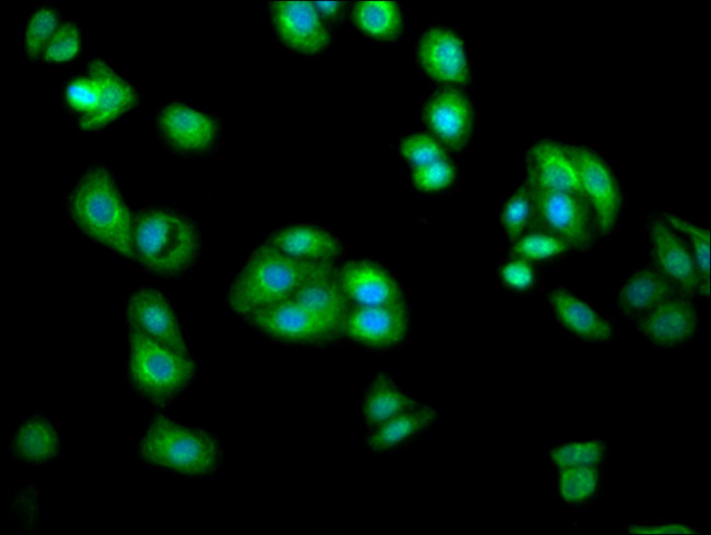 AGXT2 Antibody in Immunocytochemistry (ICC/IF)