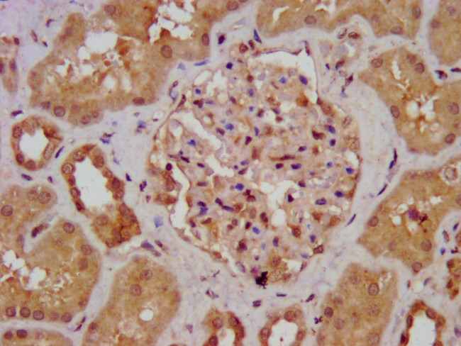 AGXT2 Antibody in Immunohistochemistry (Paraffin) (IHC (P))