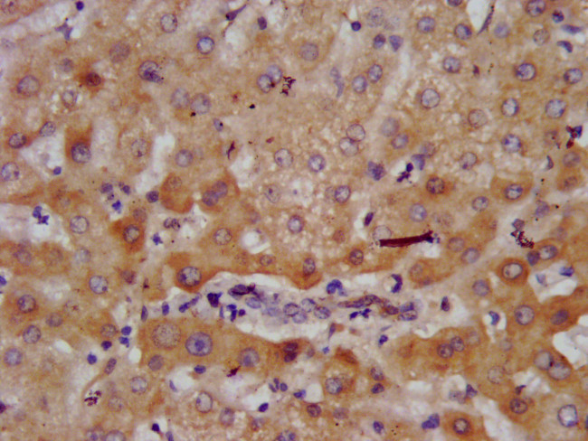 AGXT2 Antibody in Immunohistochemistry (Paraffin) (IHC (P))