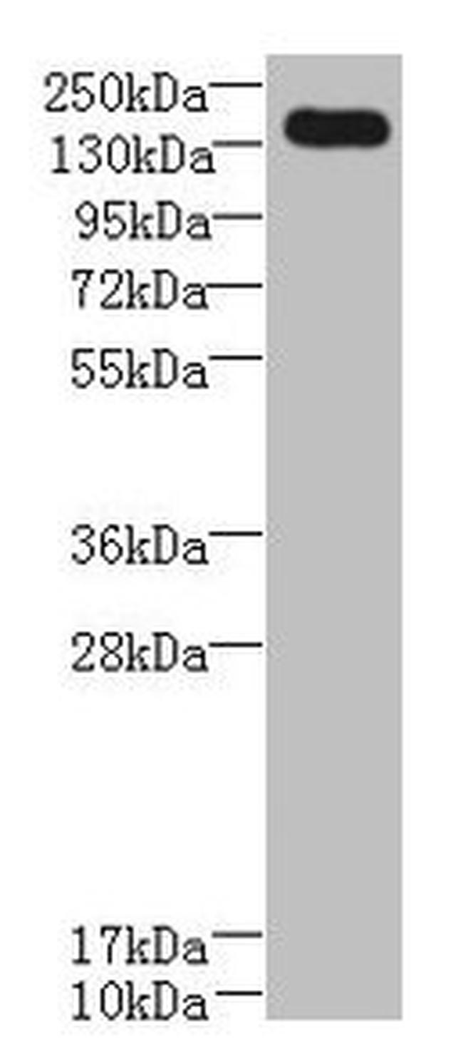 UBE2O Antibody in Western Blot (WB)