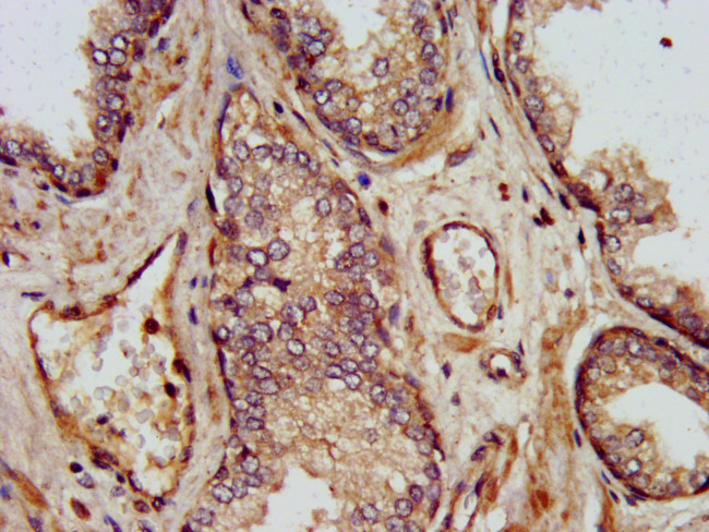 SHARPIN Antibody in Immunohistochemistry (Paraffin) (IHC (P))